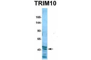 Host:  Rabbit  Target Name:  TRIM10  Sample Type:  721_B  Antibody Dilution:  1.