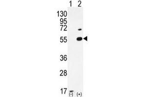 Western blot analysis of PRMT2 antibody and 293 cell lysate either nontransfected (Lane 1) or transiently transfected (2) with the PRMT2 gene. (PRMT2 anticorps  (AA 22-53))