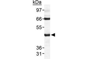 Western blot analysis of TARDBP in HeLa whole cell extract with TARDBP polyclonal antibody . (TARDBP anticorps  (AA 350-414))