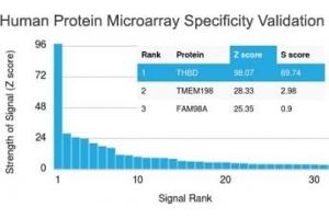 Analysis of HuProt(TM) microarray containing more than 19,000 full-length human proteins using Thrombomodulin antibody (clone rTHBD/1591).