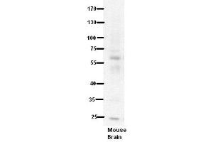 WB Suggested Anti-PDE9A Antibody Titration:  5% Milk  ELISA Titer:  dilution: 1:500  Positive Control:  Mouse Brain lysate (PDE9A anticorps  (N-Term))