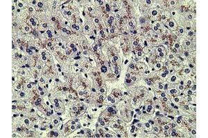 Immunohistochemistry (IHC) image for anti-alpha-Fetoprotein (AFP) antibody (ABIN1496485)