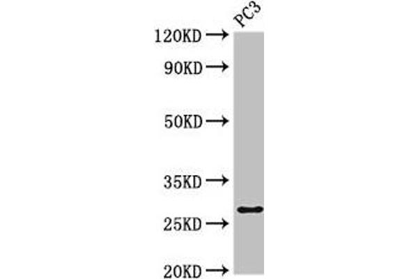 IL-34 anticorps  (AA 191-240)
