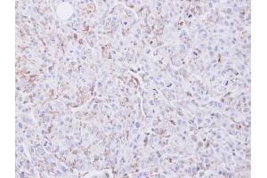 IHC-P Image Immunohistochemical analysis of paraffin-embedded U87 xenograft, using COX2, antibody at 1:100 dilution.