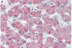 Liver, Human: Formalin-Fixed, Paraffin-Embedded (FFPE) (GPR146 anticorps  (Internal Region))