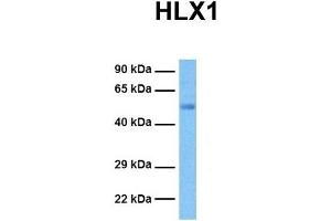 Host:  Rabbit  Target Name:  HLX1  Sample Tissue:  Human Ovary Tumor  Antibody Dilution:  1.