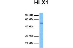 Host:  Rabbit  Target Name:  HLX1  Sample Tissue:  Human Ovary Tumor  Antibody Dilution:  1. (HLX anticorps  (Middle Region))