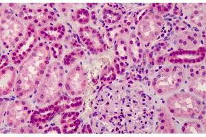 Human Kidney: Formalin-Fixed, Paraffin-Embedded (FFPE)