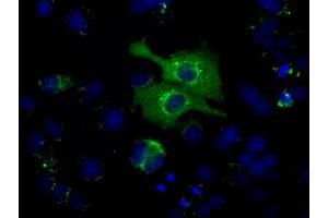 Image no. 6 for anti-Heat Shock 70kDa Protein 1A (HSPA1A) antibody (ABIN1498743)