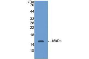 Detection of Recombinant HEXb, Mouse using Polyclonal Antibody to Hexosaminidase B Beta (HEXb) (HEXB anticorps  (AA 101-217))