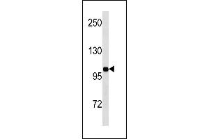 INSR Antibody (N-term) (ABIN1881461 and ABIN2843249) western blot analysis in MDA-M cell line lysates (35 μg/lane). (Insulin Receptor anticorps  (N-Term))