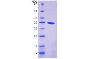 Image no. 1 for Signal-Regulatory Protein alpha (SIRPA) (AA 116-308) protein (His tag) (ABIN6237915)