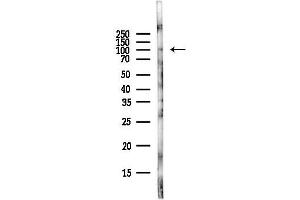 anti-Fibroblast Growth Factor Receptor 3 (FGFR3) (C-Term) antibody