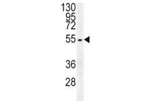 Beta III Tubulin antibody western blot analysis in HepG2 lysate (TUBB3 anticorps  (AA 36-63))