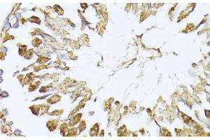 Immunohistochemistry of paraffin-embedded Rat testis using PSMA7 Polyclonal Antibody at dilution of 1:100 (40x lens). (PSMA7 anticorps)