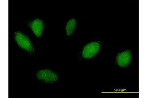 Immunofluorescence of purified MaxPab antibody to MSX1 on HeLa cell. (MSX1 anticorps  (AA 1-297))