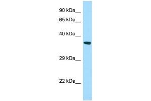 WB Suggested Anti-STARD7 Antibody Titration: 1. (STARD7 anticorps  (N-Term))