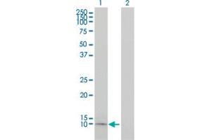 Western Blot analysis of APOC1 expression in transfected 293T cell line by APOC1 monoclonal antibody (M01), clone 2E2-1A3.