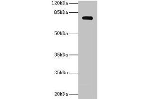 Western blot All lanes: MON1A antibody at 2 μg/mL + U251 whole cell lysate Secondary Goat polyclonal to rabbit IgG at 1/10000 dilution Predicted band size: 73, 45, 34, 56, 63 kDa Observed band size: 73 kDa (MON1A anticorps  (AA 205-555))
