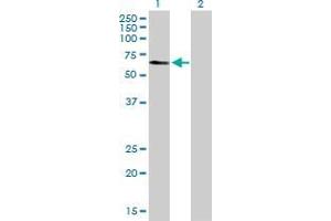 Western Blot analysis of TADA3L expression in transfected 293T cell line by TADA3L MaxPab polyclonal antibody. (TADA3L anticorps  (AA 1-369))