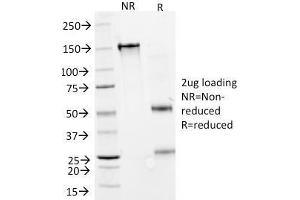 SDS-PAGE Analysis Purified GAD1 (GAD67) Mouse Monoclonal Antibody (GAD1/2391).