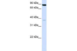 WB Suggested Anti-ACSL3 Antibody Titration:  0. (Acsl3 anticorps  (N-Term))