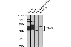 Western blot analysis of extracts of various cell lines, using  antibody  at 1:1000 dilution. (ADAP1 anticorps  (AA 1-374))