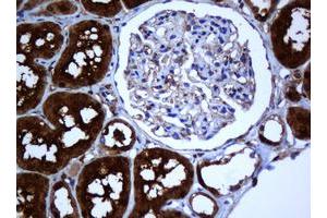 Image no. 2 for anti-Selenium Binding Protein 1 (SELENBP1) antibody (ABIN1500860)