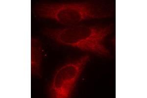 Immunofluorescence staining of methanol-fixed Hela cells using Phospho-YWHAZ-S58 antibody.