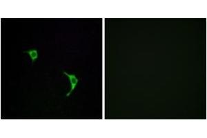 Immunofluorescence analysis of LOVO cells, using SAPK/JNK (Ab-183) Antibody. (SAPK, JNK (AA 166-215) anticorps)