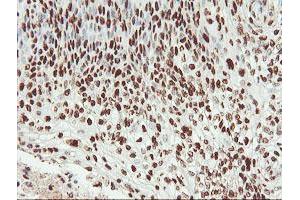 Image no. 13 for anti-SAM Domain and HD Domain 1 (SAMHD1) antibody (ABIN1500798)