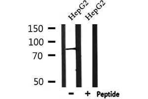 Western blot analysis of extracts from HepG2, using PIGQ Antibody. (PIGQ anticorps  (Internal Region))