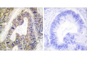 Peptide - + (EPS8-Like 1 anticorps)