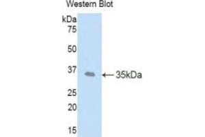 WB of Protein Standard: different control antibodies against Highly purified E. (LEFTY1 Kit CLIA)