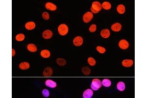 Immunofluorescence analysis of NIH-3T3 cells using Symmetric DiMethyl-Histone H3-R2 Polyclonal Antibody at dilution of 1:100 (40x lens).