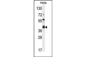 Western blot analysis of DEGS2 Antibody (C-term) in Hela cell line lysates (35ug/lane). (DEGS2 anticorps  (C-Term))