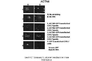 Sample Type :  ACTNX-GFP transfected COS-7 cells  Primary Antibody Dilution :  1:1000  Secondary Antibody :  Anti-rabbit-Alexa-Fluor 568  Secondary Antibody Dilution :  1:100  Color/Signal Descriptions :  Green: GFP Red: ACTN4  Gene Name :  ACTN4  Submitted by :  Johannes W.