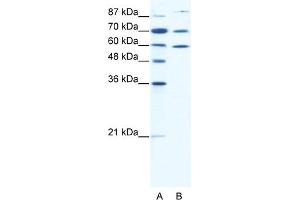WB Suggested Anti-HSP90AB1 Antibody Titration:  0. (HSP90AB1 anticorps  (N-Term))