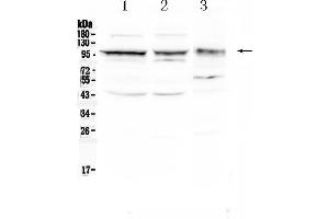 Western blot analysis of CD166/ALCAM using anti- CD166/ALCAM antibody . (CD166 anticorps  (AA 167-406))