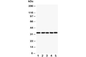 Western blot testing of E2F6 antibody and Lane 1:  HeLa;  2: COLO320;  3: A549;  4: MCF-7;  5: SMMC-7721 cell lysate (E2F6 anticorps  (Middle Region))