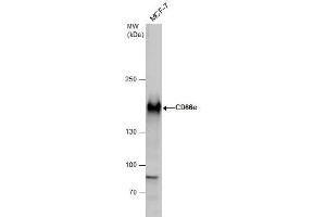 WB Image CD66e antibody detects CD66e protein by western blot analysis.