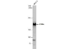 WB Image CD66e antibody detects CD66e protein by western blot analysis. (CEACAM5 anticorps)