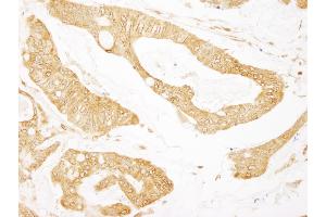 Immunohistochemistry (IHC) image for anti-Breast Cancer Anti-Estrogen Resistance 1 (BCAR1) (AA 275-325) antibody (ABIN7448429)