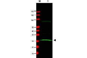 Western Blotting (WB) image for anti-MAD2 Mitotic Arrest Deficient-Like 1 (Yeast) (MAD2L1) antibody (ABIN400793) (MAD2L1 anticorps)