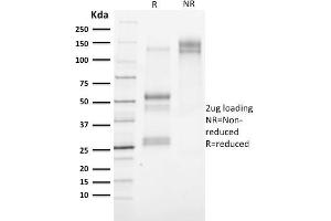 SDS-PAGE Analysis Purified Cytokeratin 3 Mouse Monoclonal Antibody (KRT3/2130). (Keratin 3 anticorps)