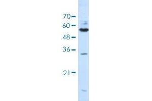 Western blot analysis of Jurkat cell lysate with KHDRBS3 polyclonal antibody . (KHDRBS3 anticorps  (AA 281-330))