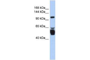 WB Suggested Anti-LRRC8B Antibody Titration:  0. (LRRC8B anticorps  (N-Term))