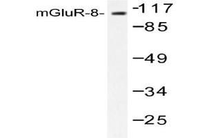 Image no. 1 for anti-Glutamate Receptor, Metabotropic 8 (GRM8) antibody (ABIN265441) (GRM8 anticorps)