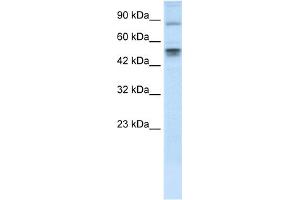 WB Suggested Anti-MDM4 Antibody Titration: 0. (MDM4-binding Protein anticorps  (N-Term))