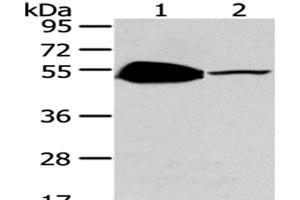 Western Blot analysis of Mouse brain and heart tissue using TSPYL1 Polyclonal Antibody at dilution of 1/200 (TSPYL1 anticorps)